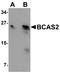BCAS2 Pre-MRNA Processing Factor antibody, A07113, Boster Biological Technology, Western Blot image 