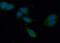 Carnitine O-Acetyltransferase antibody, FNab01952, FineTest, Immunofluorescence image 