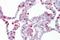 Hematopoietic Prostaglandin D Synthase antibody, A05745, Boster Biological Technology, Immunohistochemistry frozen image 