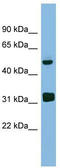 Cell growth-regulating nucleolar protein antibody, TA344960, Origene, Western Blot image 