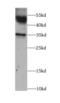 ATPase Na+/K+ Transporting Subunit Beta 1 antibody, FNab00696, FineTest, Western Blot image 