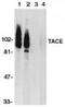 ADAM 17 antibody, TA305951, Origene, Western Blot image 