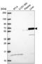 Dihydropyrimidinase Like 5 antibody, NBP2-55982, Novus Biologicals, Western Blot image 