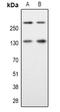Spectrin alpha chain, brain antibody, LS-C368787, Lifespan Biosciences, Western Blot image 