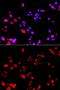 Replication Protein A2 antibody, GTX32844, GeneTex, Immunocytochemistry image 
