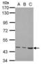 Matrix Metallopeptidase 19 antibody, PA5-28213, Invitrogen Antibodies, Western Blot image 