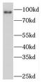 Polycystin 2 Like 1, Transient Receptor Potential Cation Channel antibody, FNab06488, FineTest, Western Blot image 
