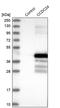 Coiled-Coil Domain Containing 24 antibody, PA5-57266, Invitrogen Antibodies, Western Blot image 