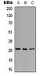 Replication protein A 30 kDa subunit antibody, LS-C354481, Lifespan Biosciences, Western Blot image 