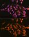 Proteasome 26S Subunit, Non-ATPase 13 antibody, GTX33438, GeneTex, Immunofluorescence image 
