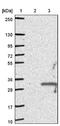 COMM Domain Containing 10 antibody, NBP1-91801, Novus Biologicals, Western Blot image 