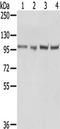 TPX2 Microtubule Nucleation Factor antibody, TA350529, Origene, Western Blot image 