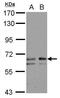 Polypeptide N-Acetylgalactosaminyltransferase 2 antibody, PA5-31096, Invitrogen Antibodies, Western Blot image 