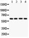 Beta-hexosaminidase subunit alpha antibody, PA5-79358, Invitrogen Antibodies, Western Blot image 