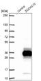 Zinc Finger CCHC-Type Containing 10 antibody, PA5-58602, Invitrogen Antibodies, Western Blot image 