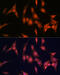 P21 (RAC1) Activated Kinase 2 antibody, GTX02856, GeneTex, Immunofluorescence image 