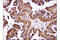 Lysosomal Associated Membrane Protein 1 antibody, 9091P, Cell Signaling Technology, Immunohistochemistry paraffin image 