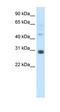 Distal-Less Homeobox 5 antibody, orb329994, Biorbyt, Western Blot image 