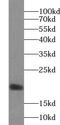 Vesicle Associated Membrane Protein 4 antibody, FNab09362, FineTest, Western Blot image 