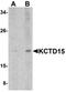 Potassium Channel Tetramerization Domain Containing 15 antibody, orb75167, Biorbyt, Western Blot image 