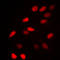 NCOR1 antibody, LS-C353192, Lifespan Biosciences, Immunofluorescence image 
