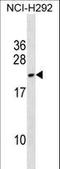 DPY30 Domain Containing 2 antibody, LS-C159498, Lifespan Biosciences, Western Blot image 