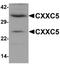 CXXC Finger Protein 5 antibody, orb95574, Biorbyt, Western Blot image 