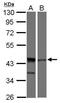 DNA Fragmentation Factor Subunit Alpha antibody, PA5-34694, Invitrogen Antibodies, Western Blot image 
