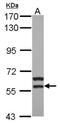 Megakaryocyte-Associated Tyrosine Kinase antibody, NBP2-17231, Novus Biologicals, Western Blot image 
