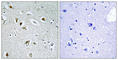 Cyclin Dependent Kinase 2 Associated Protein 2 antibody, abx013329, Abbexa, Western Blot image 