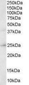 Hydroxysteroid 17-Beta Dehydrogenase 10 antibody, GTX48613, GeneTex, Western Blot image 