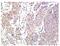 Checkpoint Kinase 1 antibody, AP20930PU-N, Origene, Immunohistochemistry frozen image 