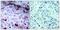 Janus Kinase 1 antibody, PA5-37617, Invitrogen Antibodies, Immunohistochemistry frozen image 