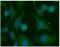KRAS Proto-Oncogene, GTPase antibody, GTX31957, GeneTex, Immunofluorescence image 