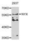 Nyctalopin antibody, A7830, ABclonal Technology, Western Blot image 