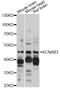 Potassium Voltage-Gated Channel Subfamily A Regulatory Beta Subunit 3 antibody, LS-C749804, Lifespan Biosciences, Western Blot image 