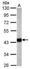 Pyruvate Dehydrogenase E1 Alpha 1 Subunit antibody, TA308687, Origene, Western Blot image 
