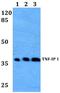 TNF Alpha Induced Protein 1 antibody, A06143S122, Boster Biological Technology, Western Blot image 