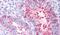 Seprase antibody, PA5-32765, Invitrogen Antibodies, Immunohistochemistry frozen image 
