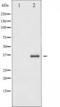 NFKB Inhibitor Beta antibody, TA325731, Origene, Western Blot image 