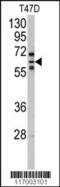 Cytochrome P450 Family 2 Subfamily C Member 8 antibody, 63-324, ProSci, Western Blot image 