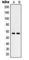 Ammonium transporter Rh type C antibody, LS-C353448, Lifespan Biosciences, Western Blot image 