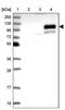 Ring Finger And CCCH-Type Domains 2 antibody, PA5-60151, Invitrogen Antibodies, Western Blot image 