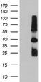Metalloproteinase inhibitor 2 antibody, TA504017BM, Origene, Western Blot image 