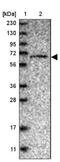 F-Box Protein 31 antibody, NBP1-83916, Novus Biologicals, Western Blot image 