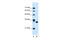 Carbonyl Reductase 1 antibody, 30-118, ProSci, Enzyme Linked Immunosorbent Assay image 