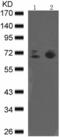 Spleen Associated Tyrosine Kinase antibody, TA323860, Origene, Western Blot image 