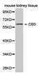 Cystathionine beta-synthase antibody, TA327044, Origene, Western Blot image 