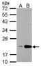 Peptidylprolyl Isomerase B antibody, PA5-31172, Invitrogen Antibodies, Western Blot image 