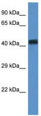 WD Repeat Domain 77 antibody, TA344238, Origene, Western Blot image 